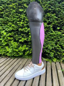 Photo d'un cover de coté personnalisé en noir et rose sur une prothèse de jambe tibiale.